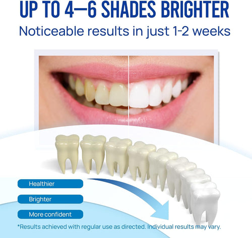 BrightSmile Fast-Action Teeth Whitening Pen