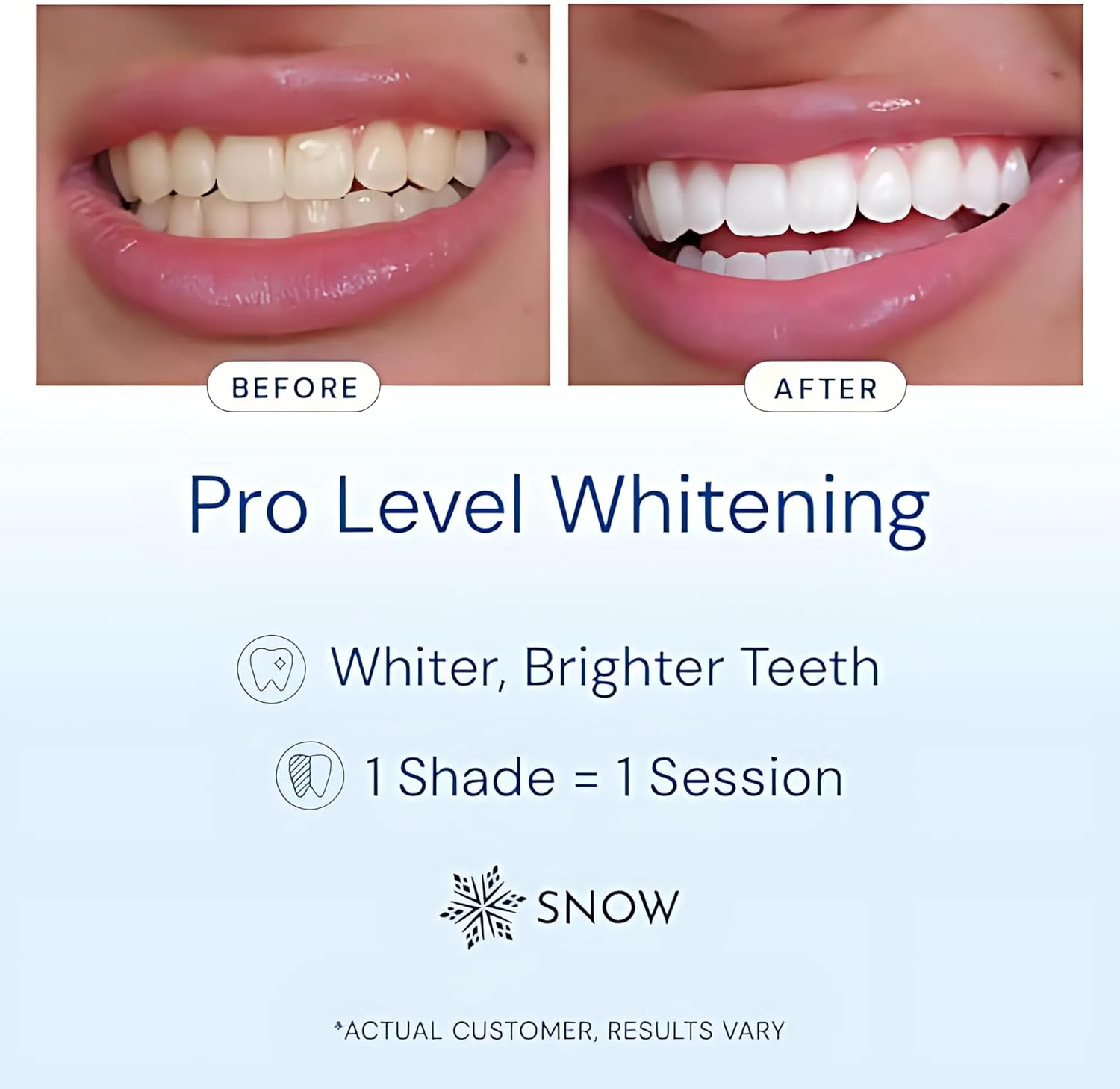 BrightSmile Pro Teeth Whitening Kit — Diamond Wired Wand